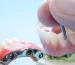 Implants adds