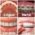 orthodontic treatment