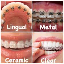 orthodontic treatment