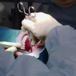 dds-surgery
