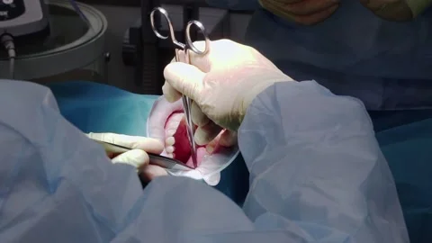 dds-surgery